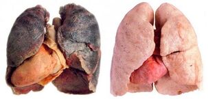 pulmões de fumante e saudáveis